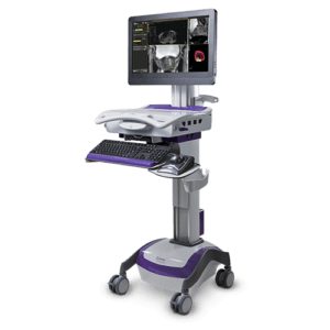 UroNav fusion biopsy system